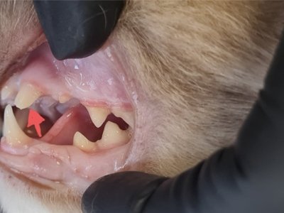 Złamanie lewego kła szczęki