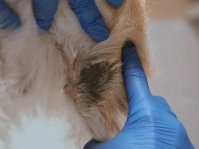 hiperpigementacja pozapalna