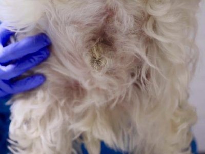 rumień skóry brzucha