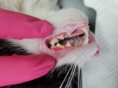 młodzieńcze zapalenie jamy ustnej z przerostem dziąseł